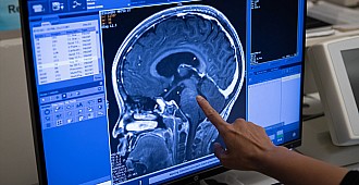 Çocuklarda görülen ölümcül beyin tümörüne…
