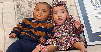 Dünyanın en erken doğan ikizleri rekorlar…