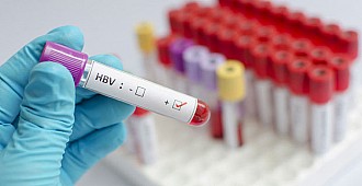Diyaliz hastalarında görülen hepatit…