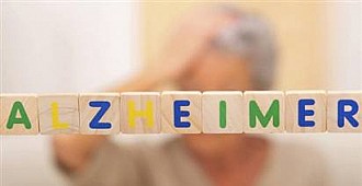 Bu meslekler Alzheimer riskini artırıyor